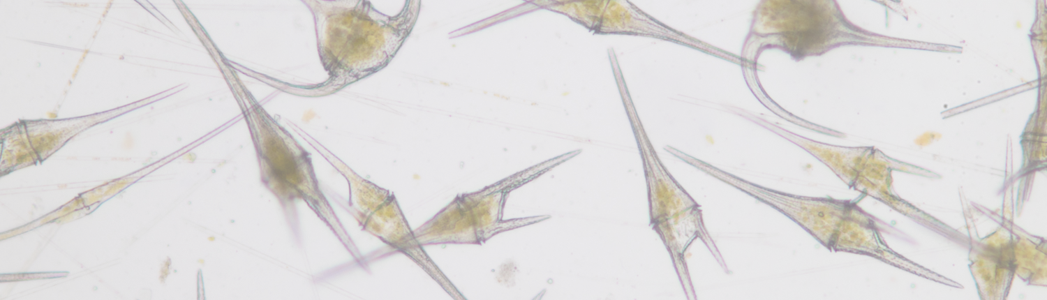 About 20 dinoflagellates under a microscope